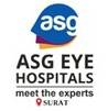 ASG